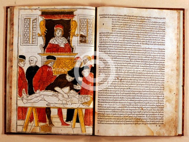 Coloured xilograph that shows for the first time the operation of a corpse dissection, 1493-1494. Creator: Johan Ketham (1415-1470).