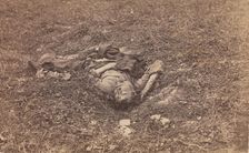 Confederate Soldier [on the Battlefield at Antietam], September 1862. Creator: Alexander Gardner