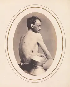 Corporal Israel Spotts, Company G, 200th Pennsylvania Volunteers, April-May 1865. Creator: Reed Brockway Bontecou