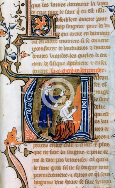 Cupping, 14th century. Artist: Unknown