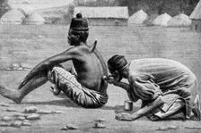Cupping, wet and dry, as a therapeutic measure, Africa, 1922.Artist: FW Taylor