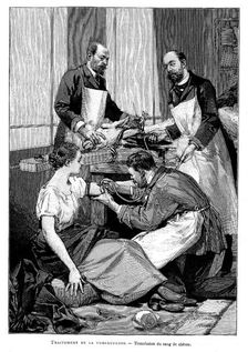 A tuberculosis patient being given a transfusion of goat's blood, 1891
