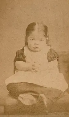 A very young girl, showing signs of mental deficiency, seated with her hands clasped upon her lap. Creator: William Moscrop