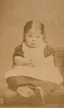 A very young girl, showing signs of mental deficiency, seated with her hands clasped upon her lap. Creator: William Moscrop