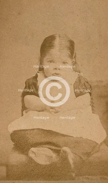 A very young girl, showing signs of mental deficiency, seated with her hands clasped upon her lap. Creator: William Moscrop.