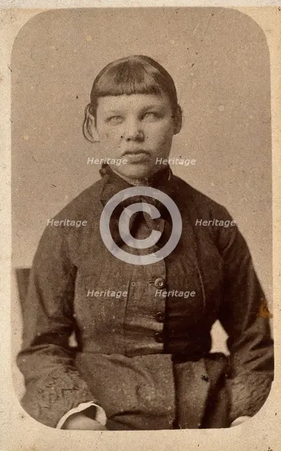 A young woman with a short fringe, showing signs of mental deficiency, c1860s. Creator: John Davis.