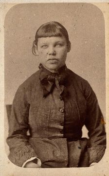 A young woman with a short fringe, showing signs of mental deficiency, c1860s. Creator: John Davis