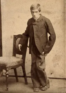 A young man, showing signs of mental deficiency, leaning awkwardly..., c1890s. Creator: Davis