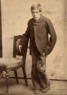 A young man, showing signs of mental deficiency, leaning awkwardly..., c1890s. Creator: Davis