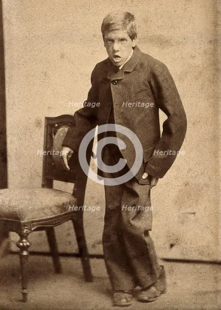 A young man, showing signs of mental deficiency, leaning awkwardly..., c1890s. Creator: Davis.