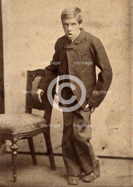 A young man, showing signs of mental deficiency, leaning awkwardly..., c1890s. Creator: Davis.