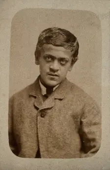 A young man, probably showing some signs of Down's syndrome, c1880s. Creator: Davis & Sons