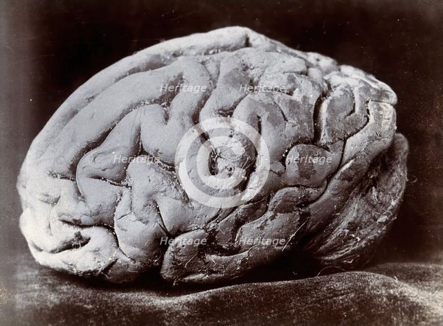 A brain, viewed from the side, supposedly from a subject with mental deficiency. Creator: N. Goulton May.