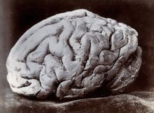 A brain, viewed from the side, supposedly from a subject with mental deficiency. Creator: N. Goulton May