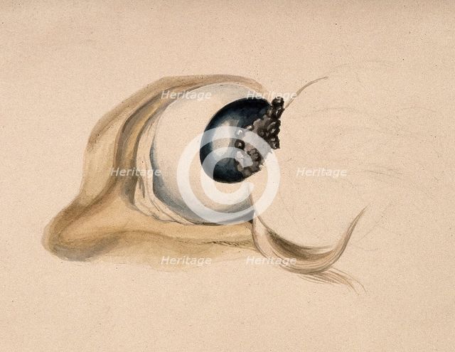 A diseased eye. Creator: Unknown.