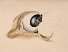 A diseased eye. Creator: Unknown