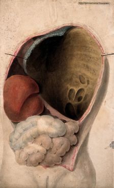 A dissected thorax with a collection of pus in the cavity, c1824. Creator: Unknown