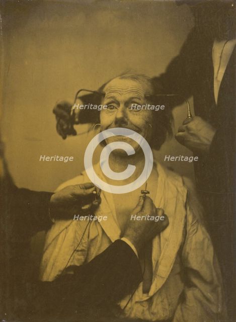 A false, incomplete expression of agreeable surprise, or admiration, 1854-1856, printed 1862. Creator: Duchenne de Boulogne.