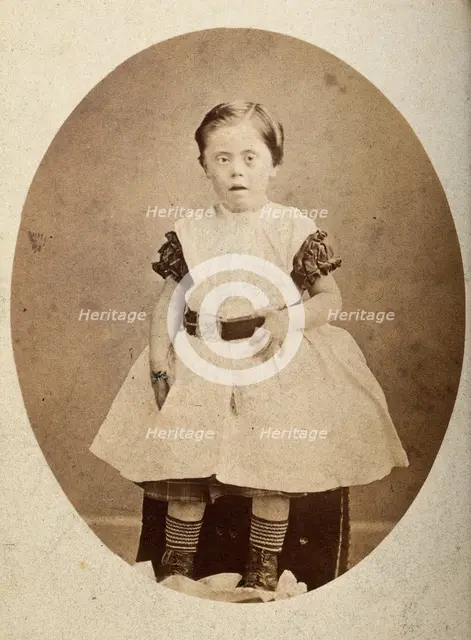 A girl with Down's syndrome, sitting, wearing striped socks, c1890s. Creator: Joseph Arthur Baldry.