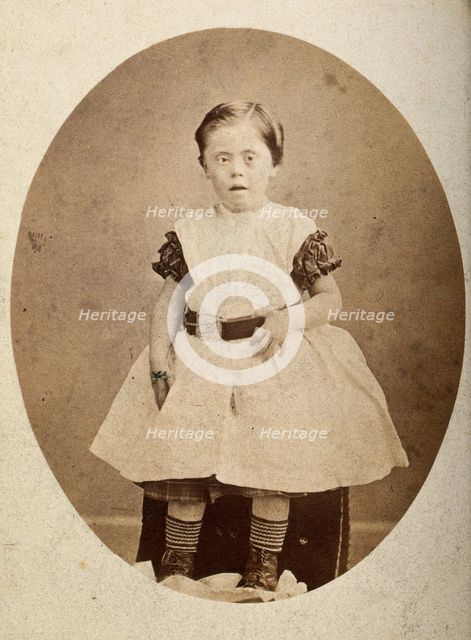A girl with Down's syndrome, sitting, wearing striped socks, c1890s. Creator: Joseph Arthur Baldry.