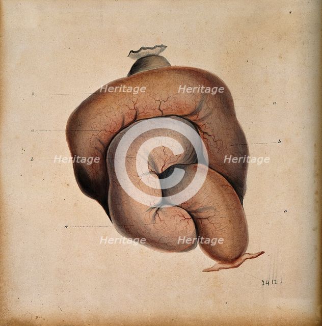 A length of coiled intestine, 1800-1899. Creator: Unknown.