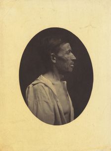 A portrait, seen in profile, of a man 42 years old, stupefied by the abuse of alcohol..., 1854-1856. Creator: Duchenne de Boulogne