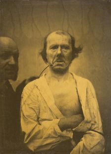A relaxed expression (left); Disgust (right), 1854-1856, printed 1862. Creator: Duchenne de Boulogne