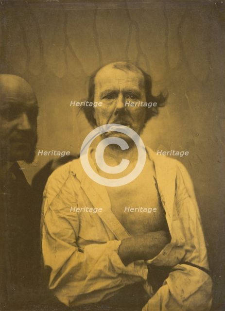 A relaxed expression (left); Disgust (right), 1854-1856, printed 1862. Creator: Duchenne de Boulogne.
