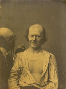 A relaxed face (left); False joy or laughter (right), 1854-1856, printed 1862. Creator: Duchenne de Boulogne