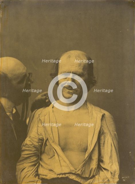 A relaxed face (left); False joy or laughter (right), 1854-1856, printed 1862. Creator: Duchenne de Boulogne.