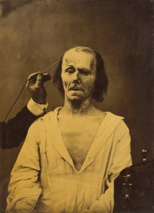 A relaxed face (left); Profound attention (right), 1854-1856, printed 1862. Creator: Duchenne de Boulogne
