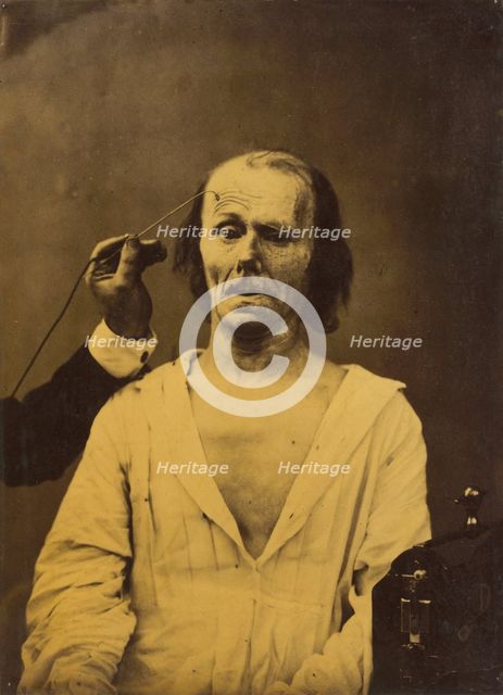 A relaxed face (left); Profound attention (right), 1854-1856, printed 1862. Creator: Duchenne de Boulogne.