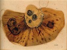A section of diseased intestine or heart, 1800-1850. Creator: Richard Bright
