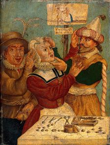 A surgeon extracting "pierres de tête", c1660s. Creator: Unknown