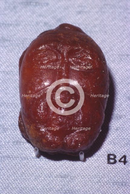 Amber Head of a Bearded Man, Viking Period, from Denmark, c8th-mid 11th century. Artist: Unknown.