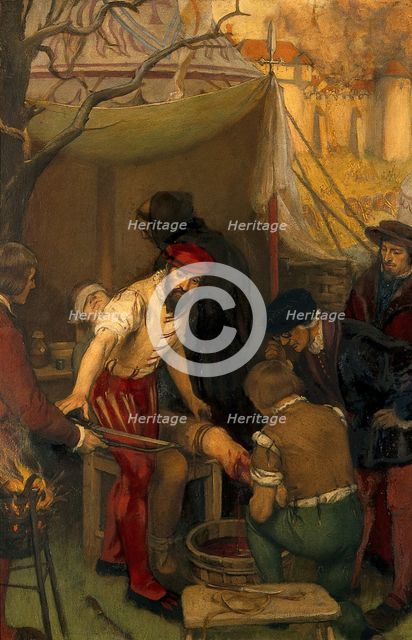 Ambroise Paré using the ligature when amputating at the siege of Damvillers, 1552, c1912. Creator: Ernest Board.