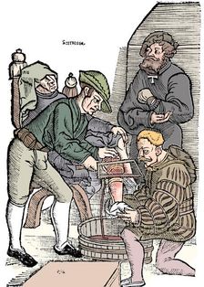 Amputation of a leg without anaesthetic, 1593