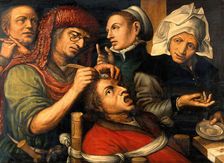 An operation for stone in the head. Creator: Follower of Jan Sanders van Hemessen