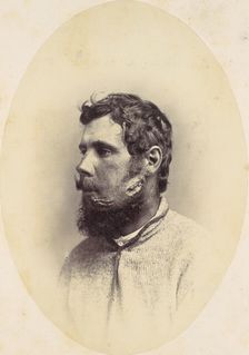 Andrew Wagoner, 1865. Creator: Reed Brockway Bontecou