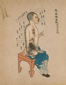 Acupuncture chart with a series of points indicated on the figure of a seated Chinese man, 1700-1799 Creator: Unknown
