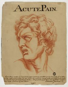Acute Pain, after 1698. Creator: Eduardus Jacobus