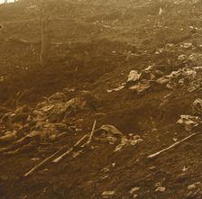 After the attack, Les Éparges, northern France, 1915