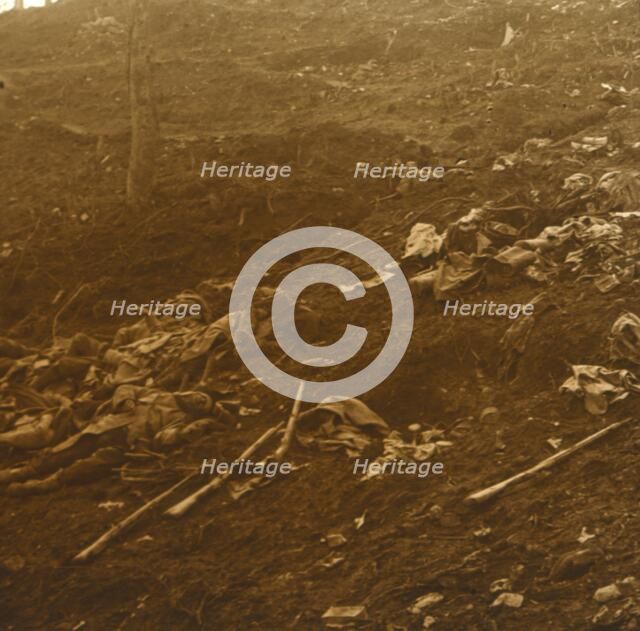 After the attack, Les Éparges, northern France, 1915.  Artist: Unknown.