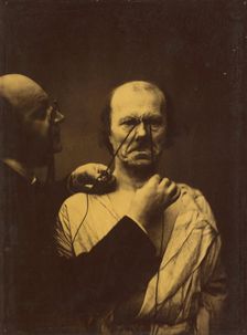 Aggression, wickedness, 1854-1856, printed 1862. Creator: Duchenne de Boulogne