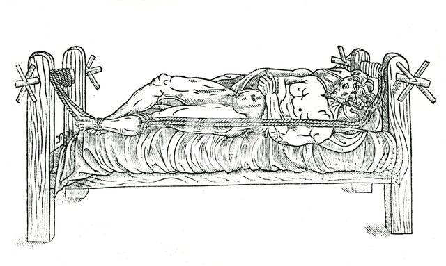 Apparatus for reducing dislocations, 1544. Creator: Unknown.