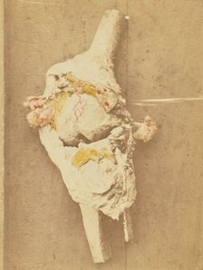 Arthropathie du genou, chez une ataxique (lésions anatomiques), 1871. Creator: Arthur de Montmeja