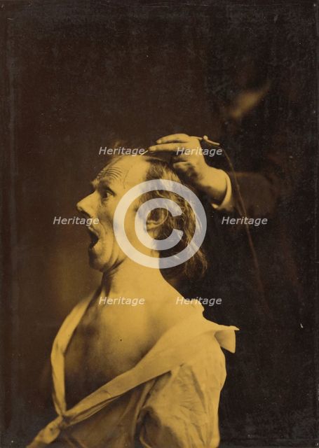 Astonishment, stupefaction, amazement, 1854-1856, printed 1862. Creator: Duchenne de Boulogne.