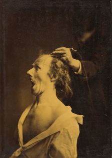 Astonishment, stupefaction, amazement, 1854-1856, printed 1862. Creator: Duchenne de Boulogne