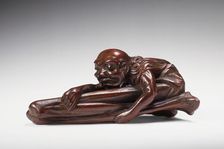 Ashinaga Applying Moxa Treatment, Mid- to late 19th century. Creator: Hokkyo Sessai