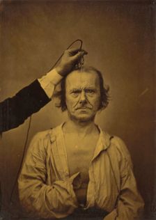 Attention (left); Severity, aggression (right), 1854-1856, printed 1862. Creator: Duchenne de Boulogne
